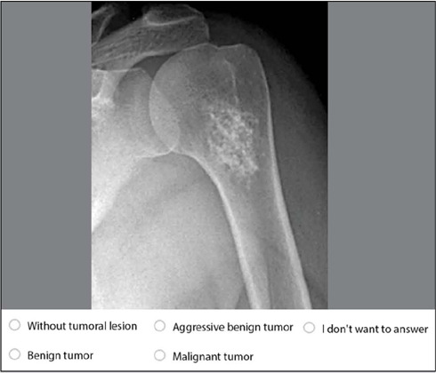 DIAGNOSTIC COMPETENCE IN BONE TUMORS: INFLUENCE OF ONCO-ORTHOPEDIC TRAINING.