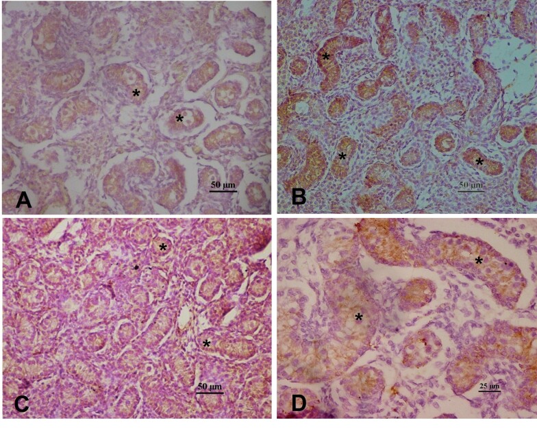 Anti-mullerian hormone (AMH) in pregnant buffaloes: maternal and fetal plasma concentrations and immunolocalization in the fetal gonads.