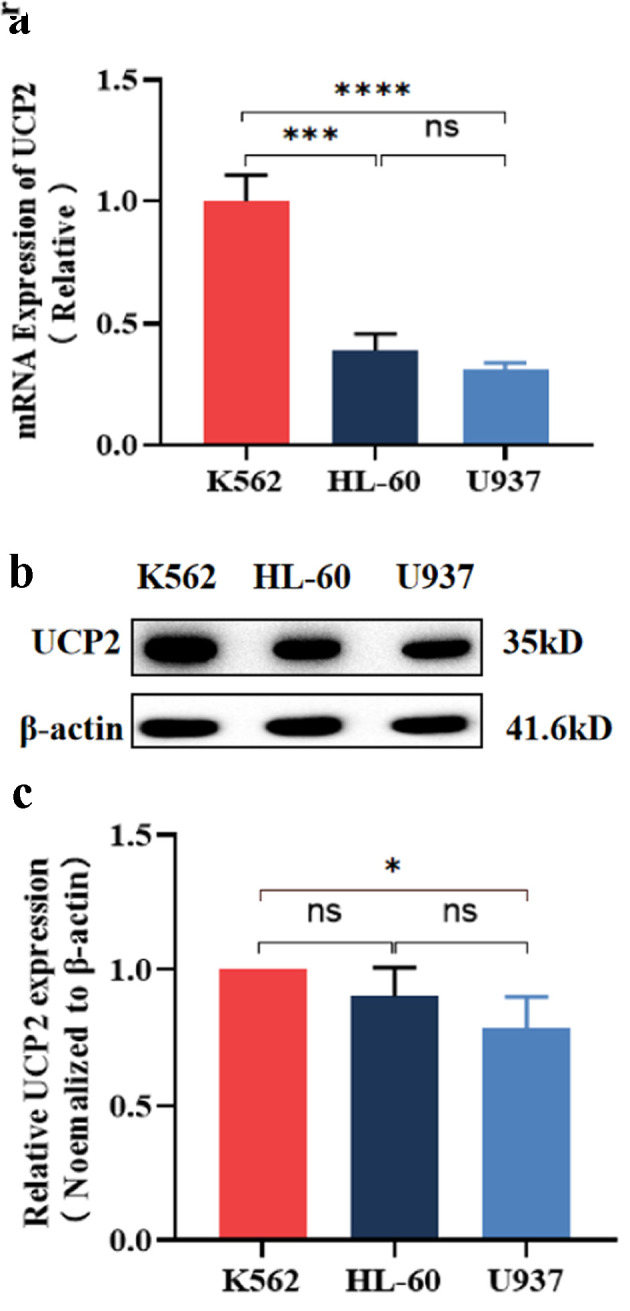Proliferation Inhibited by Genipin in Human Leukemia K562 Cells: Involvement of Uncoupling Protein 2 in Mitochondrial Damage.