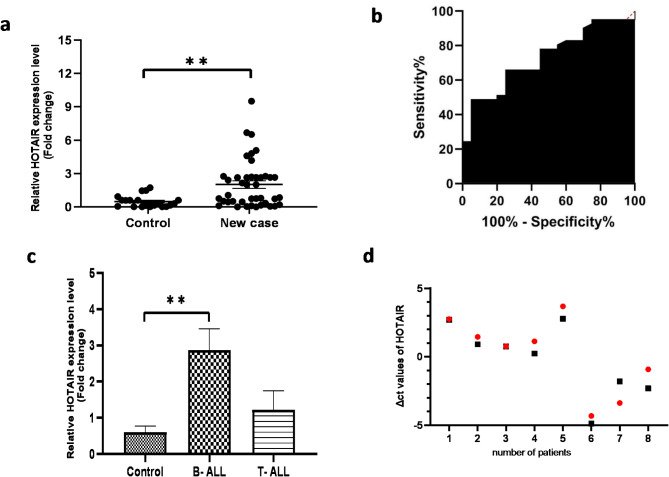 Circulating lncRNA HOTAIR is a biomarker for pediatric acute lymphoblastic leukemia and mediator of miR-326 exosomal export.