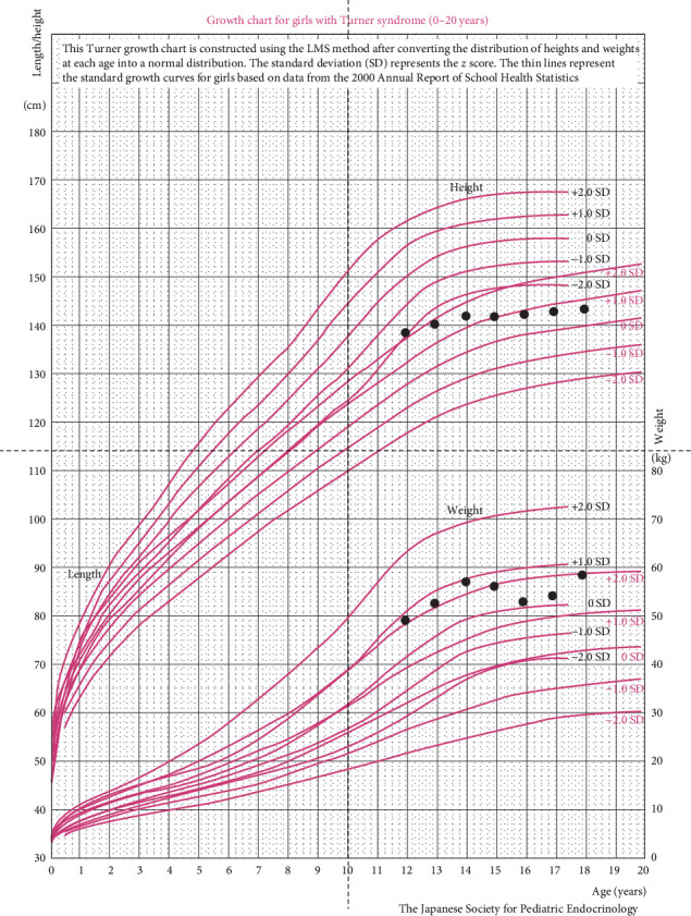 Turner Syndrome and Gender Incongruence: Considerations for Gender Affirming Hormonal Therapy.
