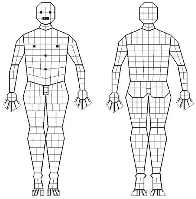 Mobile applications for the assessment of paediatric burn injuries in the Pacific Islands: A Samoan perspective for global research engagement.