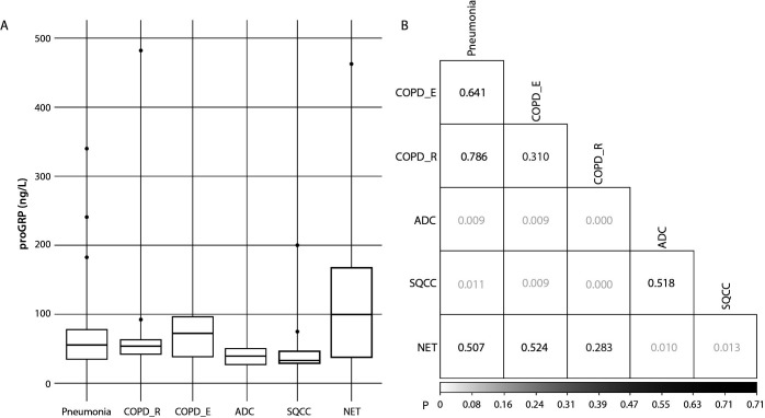 Serum progastrin-releasing peptide in pneumonia, chronic obstructive pulmonary disease and early-stage primary lung cancers.