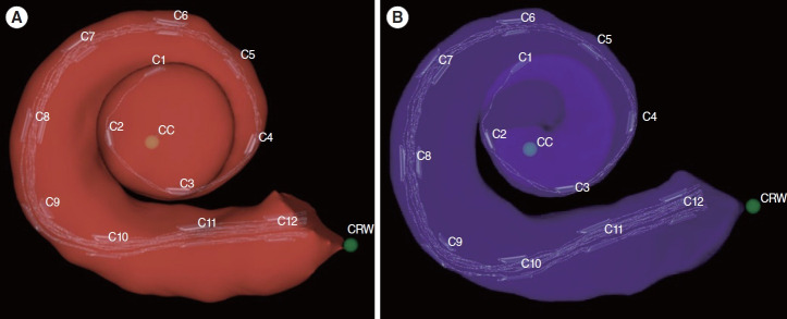 Robotic Versus Manual Electrode Insertion in Cochlear Implant Surgery: An Experimental Study.