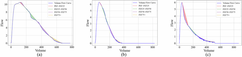 Deep learning for detecting and early predicting chronic obstructive pulmonary disease from spirogram time series.