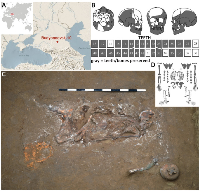 Cemento-Osseous Dysplasia in a Female Bronze Age Skeleton (North Caucasus).
