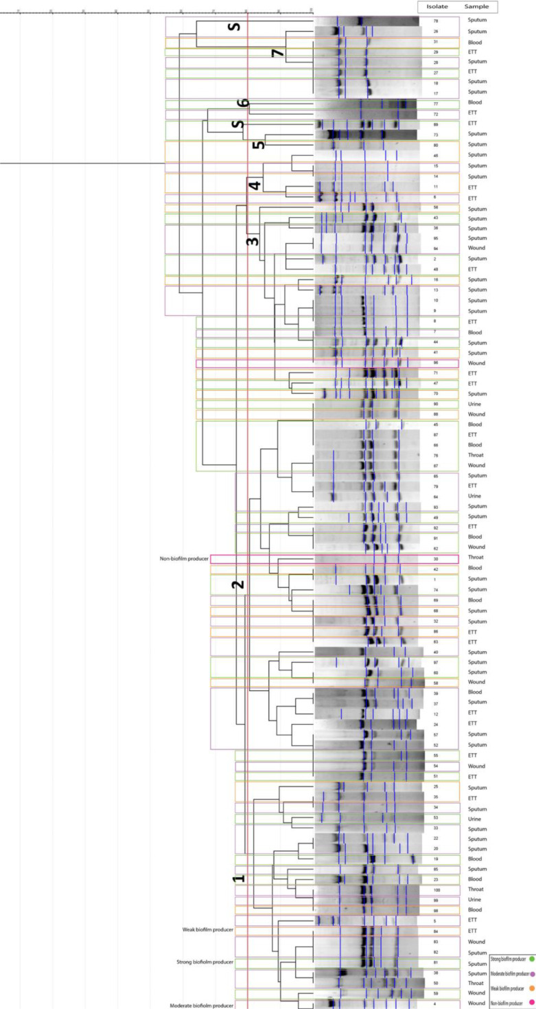 Evaluation of the relatedness between the biofilm-associated genes and antimicrobial resistance among <i>Acinetobacter baumannii</i> isolates in the southwest Iran.