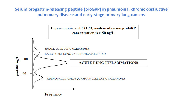 Serum progastrin-releasing peptide in pneumonia, chronic obstructive pulmonary disease and early-stage primary lung cancers.