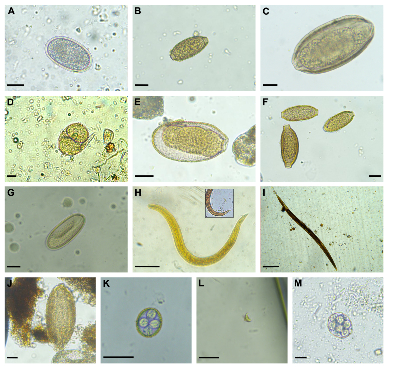 Helminths and protozoan parasites in common opossums (Didelphis marsupialis) in a suburban area in Medellín, Colombia.