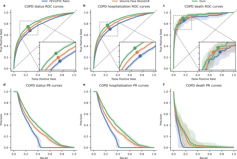 Deep learning for detecting and early predicting chronic obstructive pulmonary disease from spirogram time series.