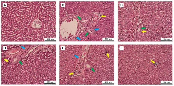 Thymoquinone mitigates diclofenac-induced hepatorenal toxicity in male Wistar rats by balancing the redox state and modulating Bax/Bcl-2/caspase-3 apoptotic pathways and NF-κB signaling.