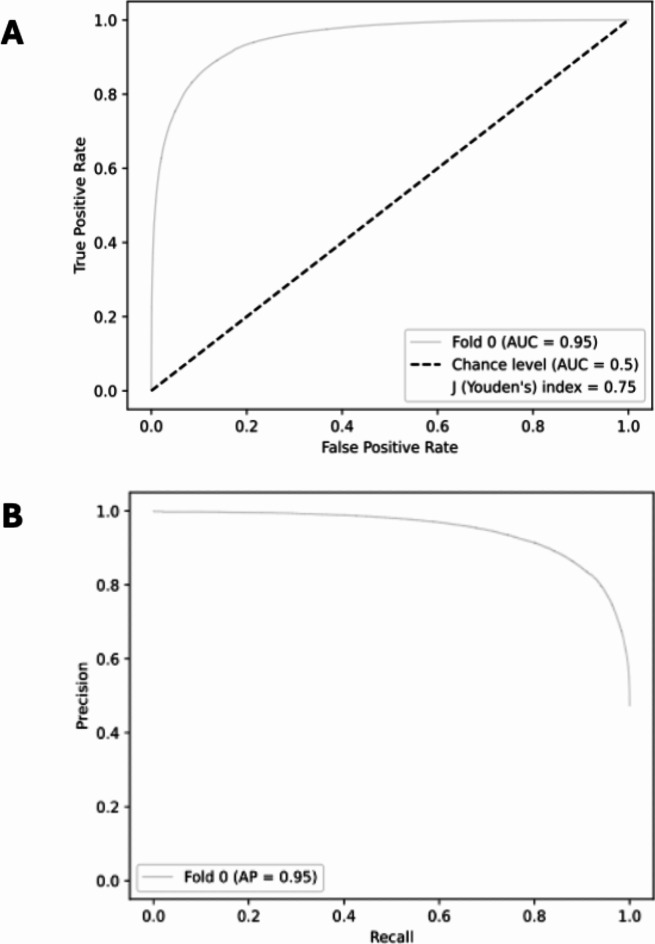 Artificial intelligence for automatic diagnosis and pleomorphic morphological characterization of malignant biliary strictures using digital cholangioscopy.
