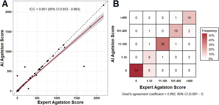 Artificial intelligence-derived coronary artery calcium scoring saves time and achieves close to radiologist-level accuracy accuracy on routine ECG-gated CT.