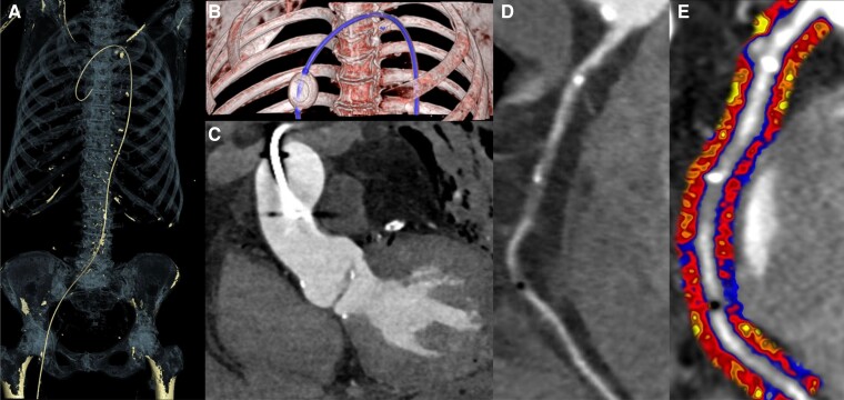 Cardiac imaging highlights from European Society of Cardiology 2024: the future is within our grasp!