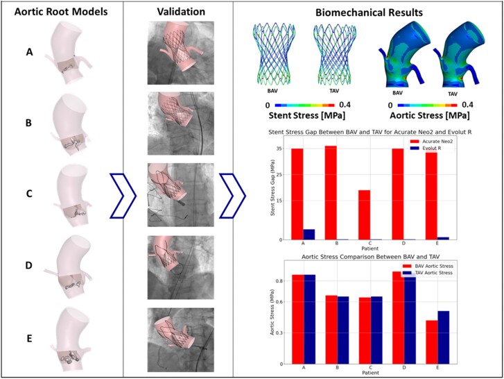 The impact of bicuspid valve morphology on the selection of transcatheter aortic valve implantation devices: an <i>in silico</i> study.