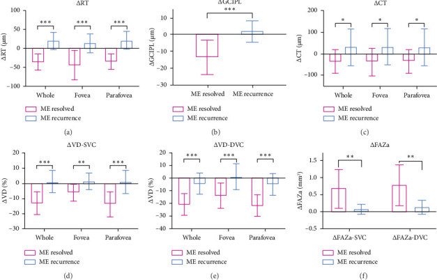 Structural and Vascular Features of Macula Related to the Recurrence of Macular Edema in Central Retinal Vein Occlusion After Anti-VEGF Therapy.