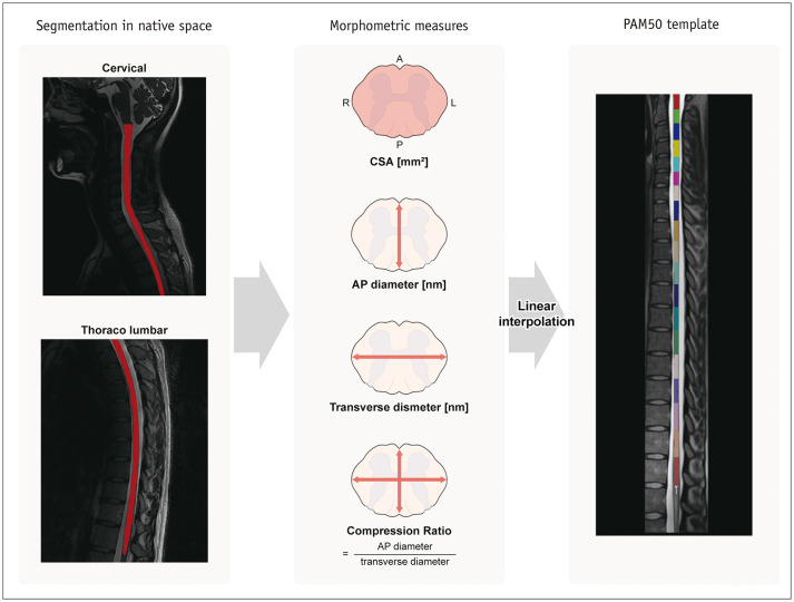 Establishing Normative Values for Entire Spinal Cord Morphometrics in East Asian Young Adults.