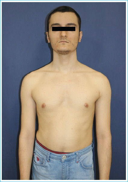 A Re-emerging Disease Linked to Complementary Medicine: Argyria.