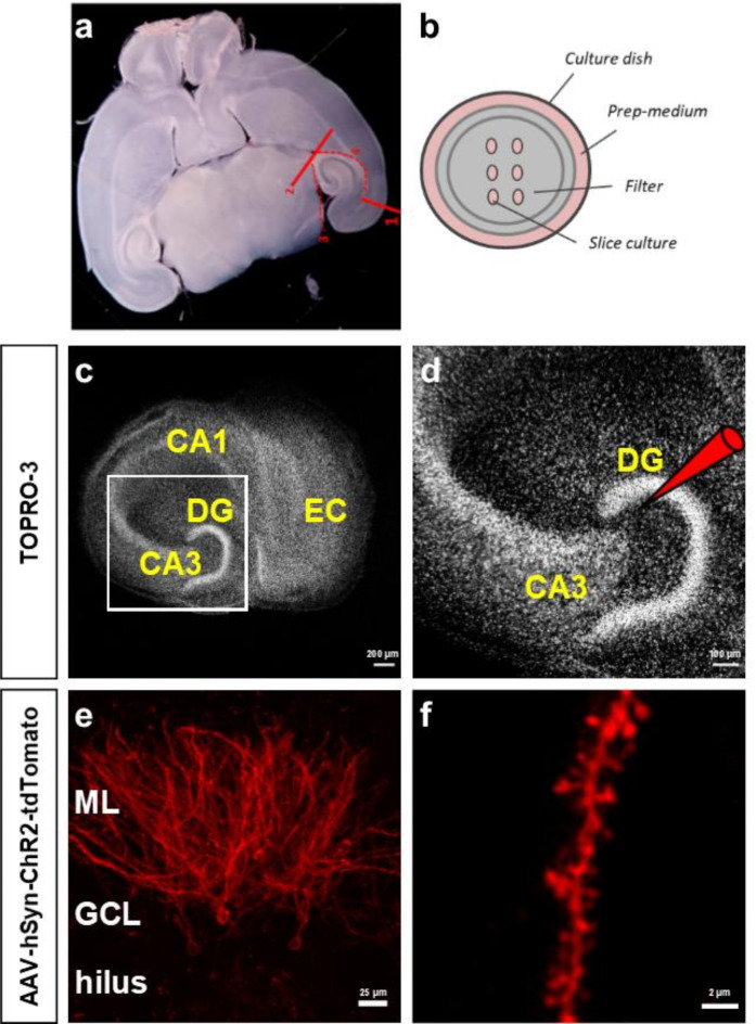 Electrophysiologically calibrated optogenetic stimulation of dentate granule cells mitigates dendritic spine loss in denervated organotypic entorhino-hippocampal slice cultures.