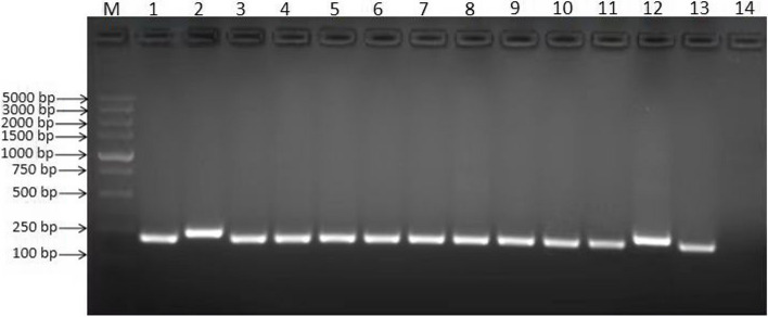 Detection of the 30-bp deletion and protein expression of Epstein-Barr virus latent membrane protein 1 in extranodal NK/T cell lymphoma and its clinicopathological significance.