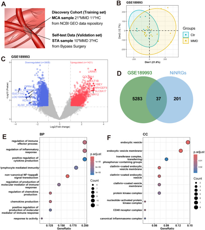 Combining machine learning with external validation to explore necroptosis and immune response in moyamoya disease.