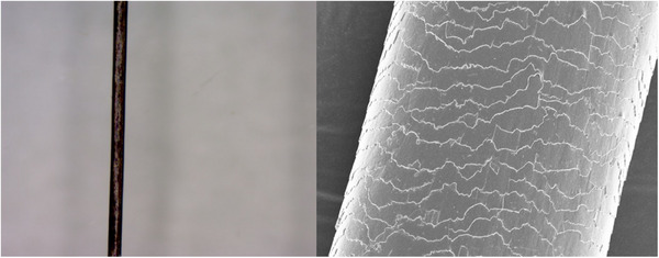New Frontiers of Non-Invasive Detection in Scalp and Hair Diseases: A Review of the Application of Novel Detection Techniques.