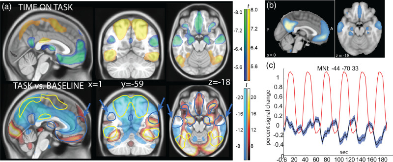 Functional imaging of time on task and habituation in passive exposure to faces with emotional expression.
