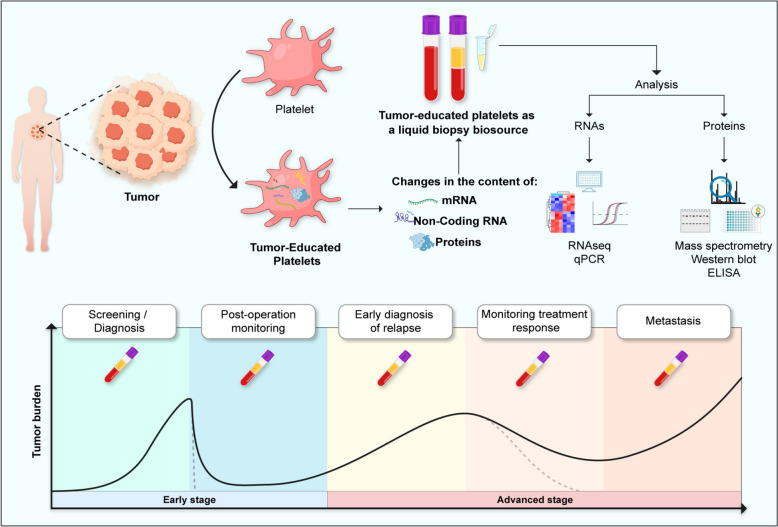 The role of platelets in cancer: from their influence on tumor progression to their potential use in liquid biopsy.