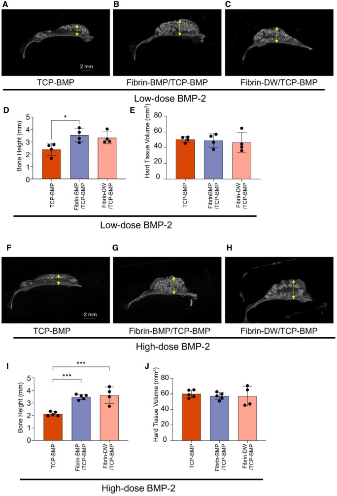 Optimizing β-TCP with E-rhBMP-2-infused fibrin for vertical bone regeneration in a mouse calvarium model.