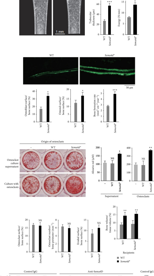Impact of Different Cell Types on the Osteogenic Differentiation Process of Mesenchymal Stem Cells.