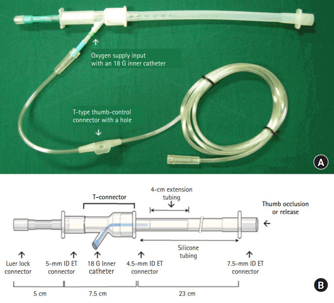Transcatheter ventilation with a modified Rapid-O2 oxygen insufflation device.