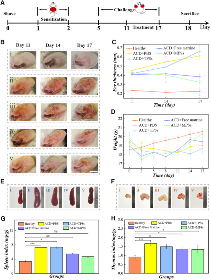 Natural Matrine-Integrated Pollen Delivery Systems for Allergic Contact Dermatitis Treatment.