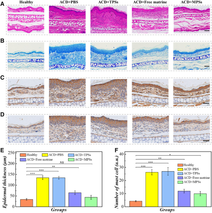 Natural Matrine-Integrated Pollen Delivery Systems for Allergic Contact Dermatitis Treatment.