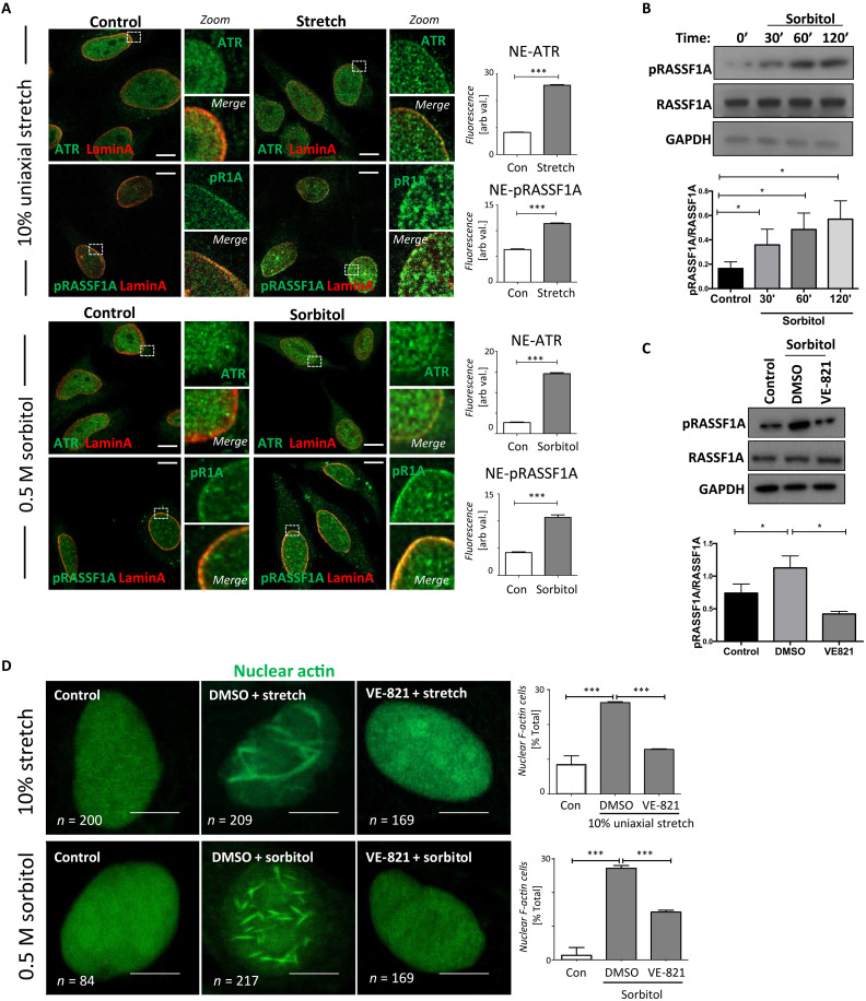 ATR-hippo drives force signaling to nuclear F-actin and links mechanotransduction to neurological disorders.