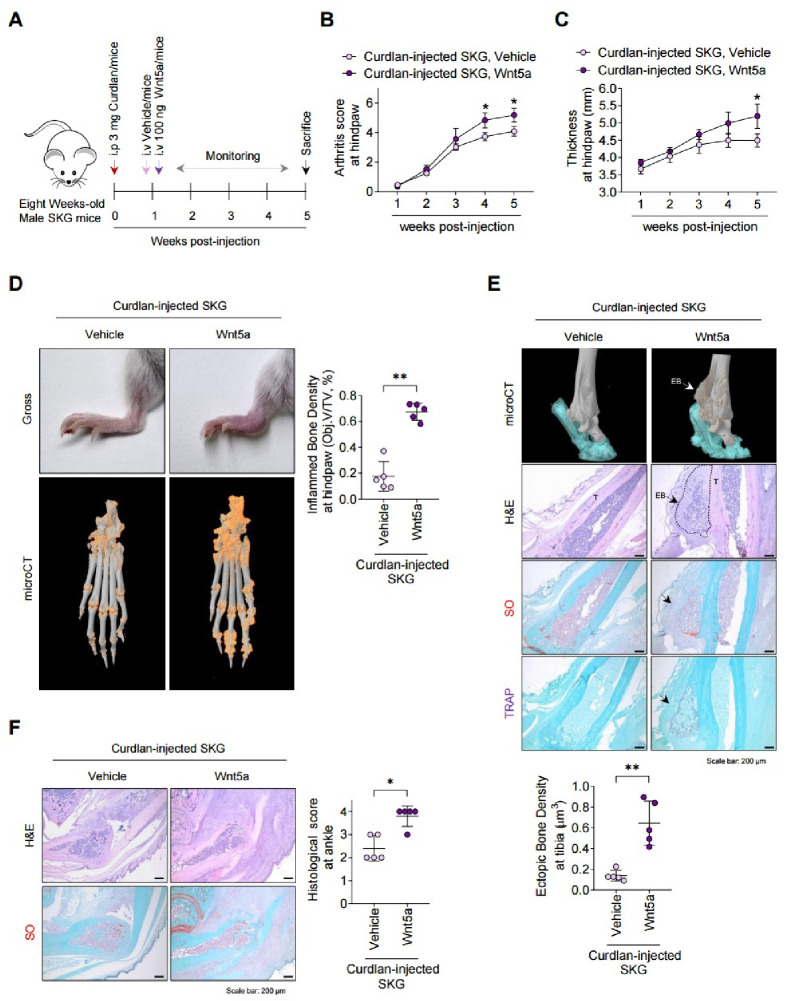 Wnt5a exacerbates pathological bone features and trabecular bone loss in curdlan-injected SKG mice via osteoclast activation.