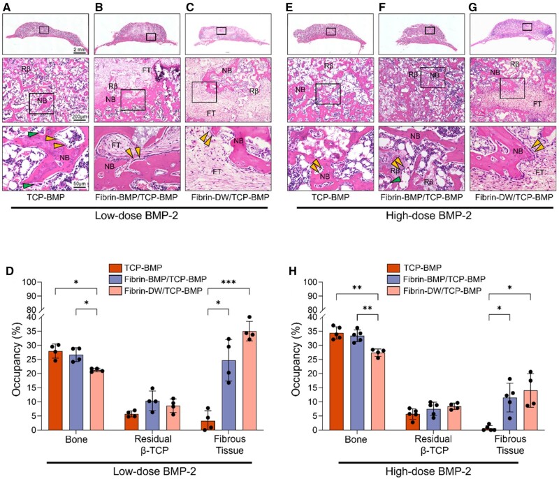Optimizing β-TCP with E-rhBMP-2-infused fibrin for vertical bone regeneration in a mouse calvarium model.