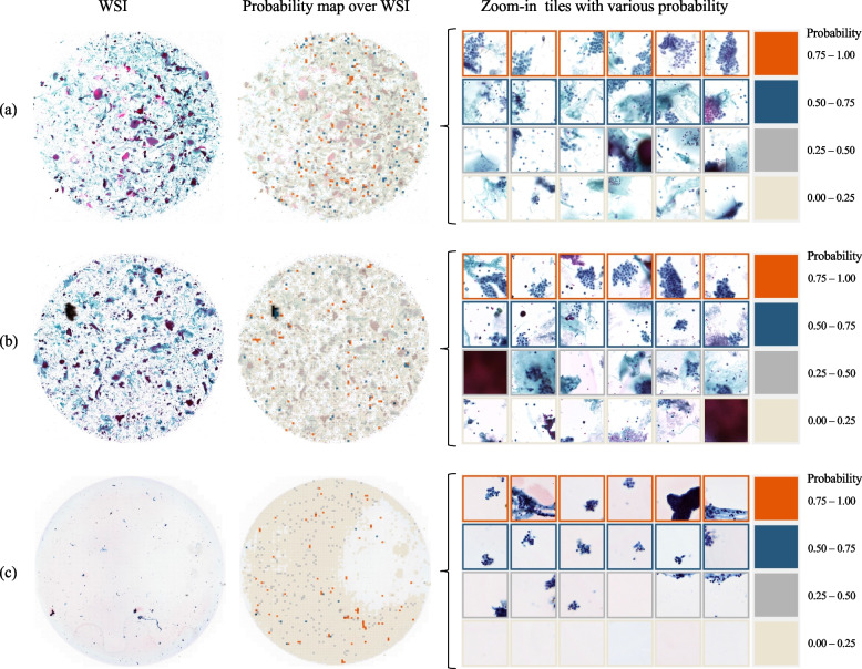 Annotation-free genetic mutation estimation of thyroid cancer using cytological slides from multi-centers.