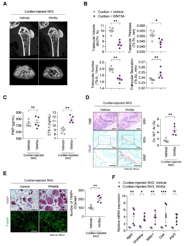 Wnt5a exacerbates pathological bone features and trabecular bone loss in curdlan-injected SKG mice via osteoclast activation.