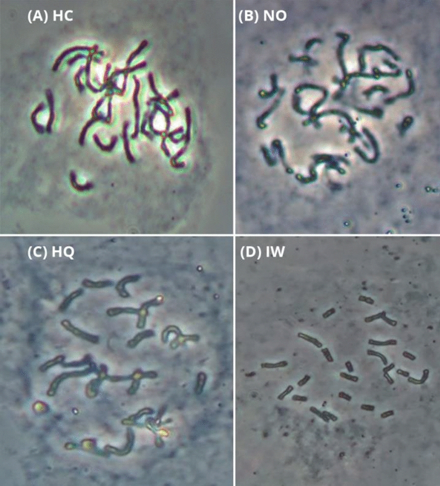 Preparing high-quality chromosome spreads from Crocus species for karyotyping and FISH.