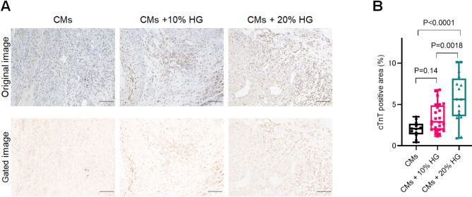 Retention of locally injected human iPS cell-derived cardiomyocytes into the myocardium using hydrolyzed gelatin.