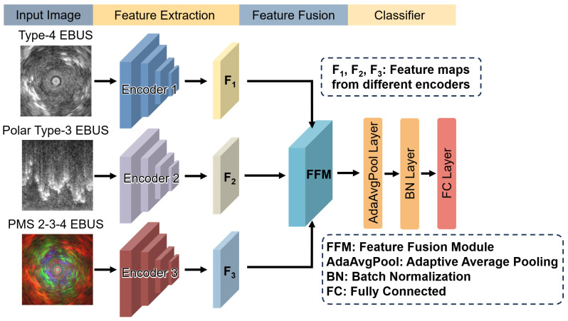 Diagnosis of Lung Cancer Using Endobronchial Ultrasonography Image Based on Multi-Scale Image and Multi-Feature Fusion Framework.