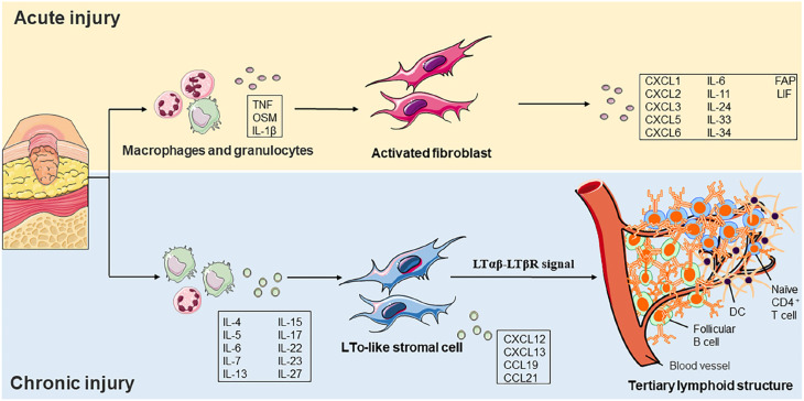Electrospinning strategies targeting fibroblast for wound healing of diabetic foot ulcers.