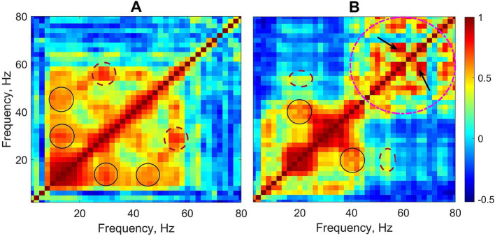 The classification of absence seizures using power-to-power cross-frequency coupling analysis with a deep learning network.