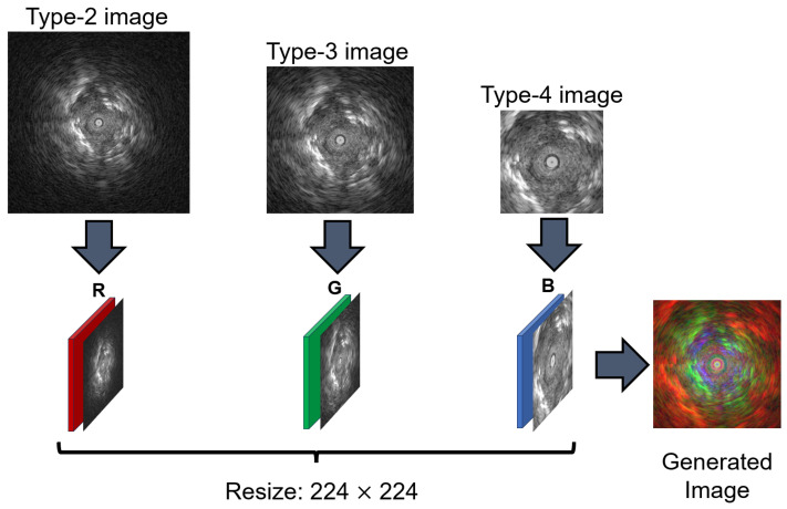 Diagnosis of Lung Cancer Using Endobronchial Ultrasonography Image Based on Multi-Scale Image and Multi-Feature Fusion Framework.
