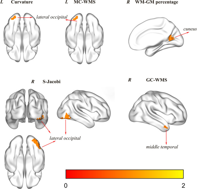 The effects of flight training on flying cadets' brain structure.