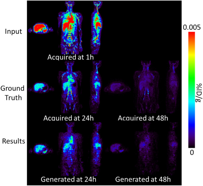 Deep learning-based organ-wise dosimetry of <sup>64</sup>Cu-DOTA-rituximab through only one scanning.