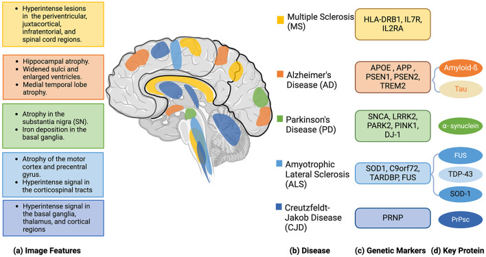 A review of AI-based radiogenomics in neurodegenerative disease.