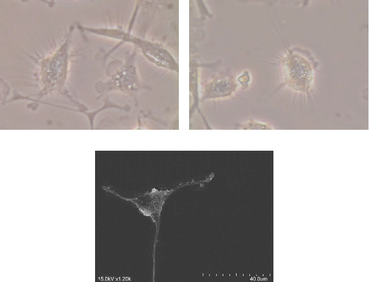 Unveiling the Interplay Between Dendritic Cells and Natural Killer Cells as Key Players in <i>Leishmania</i> Infection.