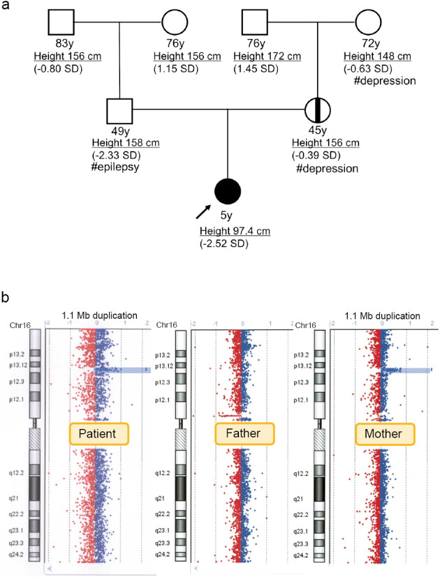 16p13.11 microduplication with growth retardation and developmental disorders: a case report and literature review.