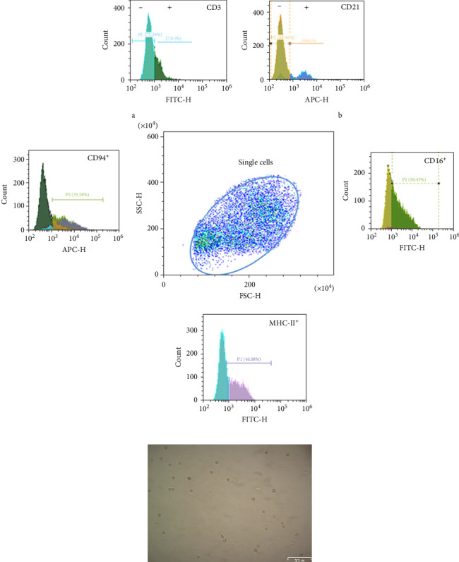 Unveiling the Interplay Between Dendritic Cells and Natural Killer Cells as Key Players in <i>Leishmania</i> Infection.